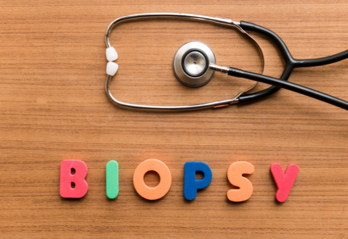 imagem lembrando da importância da biópsia para diagnóstico do câncer de mama
